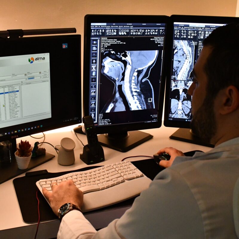 Médico radiólogo analiza una resonancia de columna